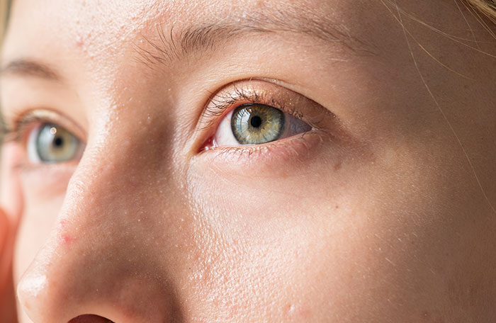 Doctors Urge Anyone With Clusters Of White Spots On Their Skin Or Intimate Areas Not To Ignore Them Doctors Urge Anyone With Clusters Of White Spots On Their Skin Or Intimate Areas Not To Ignore Them