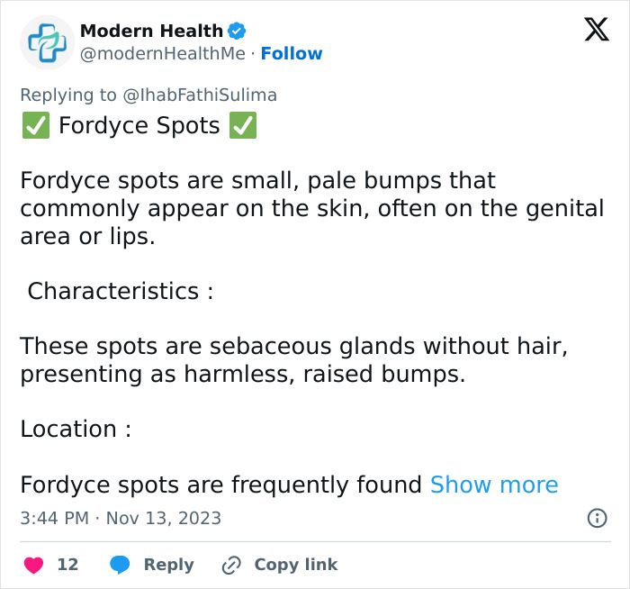 Doctors Urge Anyone With Clusters Of White Spots On Their Skin Or Intimate Areas Not To Ignore Them Doctors Urge Anyone With Clusters Of White Spots On Their Skin Or Intimate Areas Not To Ignore Them