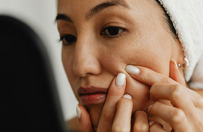 Doctors Urge Anyone With Clusters Of White Spots On Their Skin Or Intimate Areas Not To Ignore Them Doctors Urge Anyone With Clusters Of White Spots On Their Skin Or Intimate Areas Not To Ignore Them