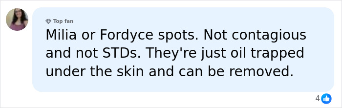 Doctors Urge Anyone With Clusters Of White Spots On Their Skin Or Intimate Areas Not To Ignore Them Doctors Urge Anyone With Clusters Of White Spots On Their Skin Or Intimate Areas Not To Ignore Them