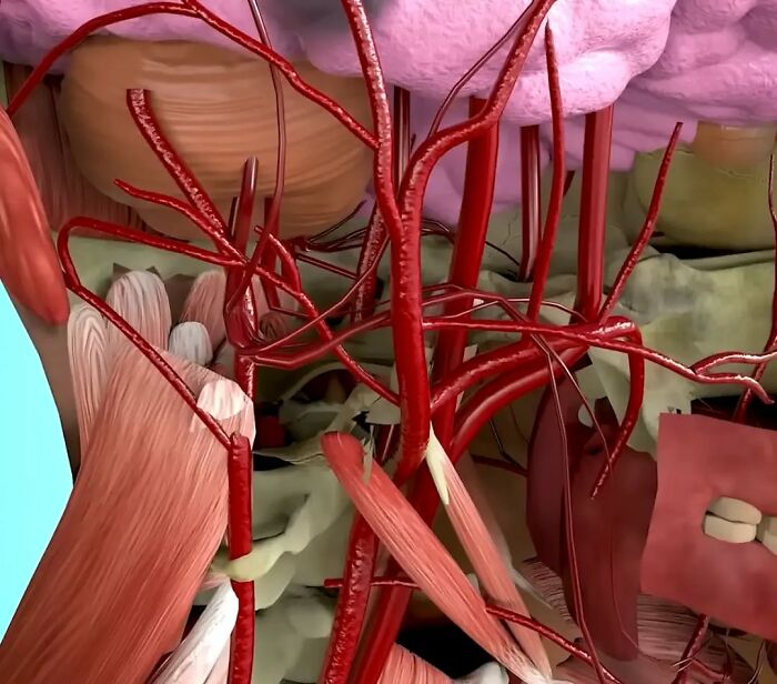 Doc Shares Graphic Simulation Of Neck Cracking, Revealing How A Simple Twist Could Lead To A Stroke Doc Shares Graphic Simulation Of Neck Cracking, Revealing How A Simple Twist Could Lead To A Stroke