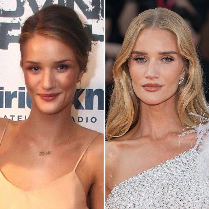 “Bulldozed Women”: Fans Decry Plastic Surgery Trend After Noticing Victoria’s Secret Models’ Transformation