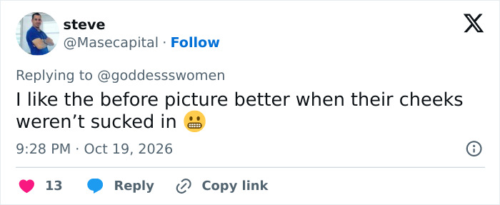“Bulldozed Women”: Fans Decry Plastic Surgery Trend After Noticing Victoria’s Secret Models’ Transformation