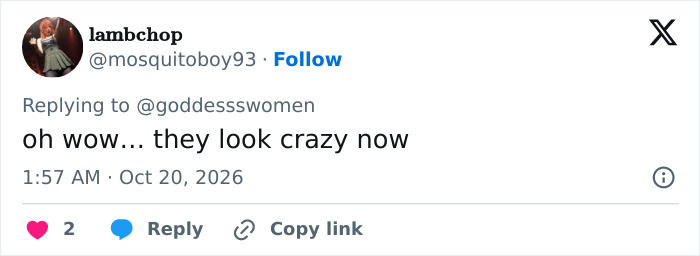 “Bulldozed Women”: Fans Decry Plastic Surgery Trend After Noticing Victoria’s Secret Models’ Transformation