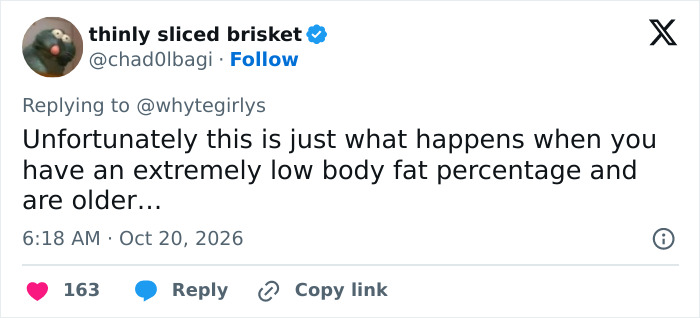 “Bulldozed Women”: Fans Decry Plastic Surgery Trend After Noticing Victoria’s Secret Models’ Transformation
