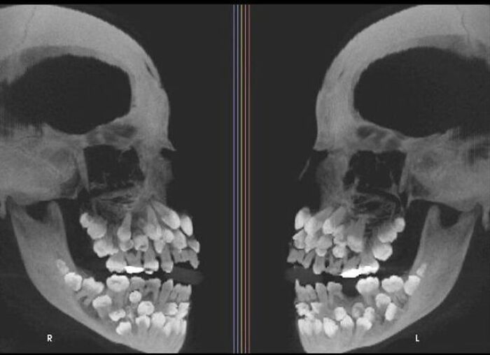 65 Really Weird And Slightly Creepy Photos That Might Give You The Heebie-Jeebies