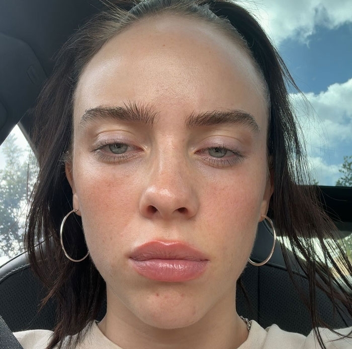 Billie Eilish Has Fans Guessing After Her Latest Photos Trigger Plastic Surgery Speculation