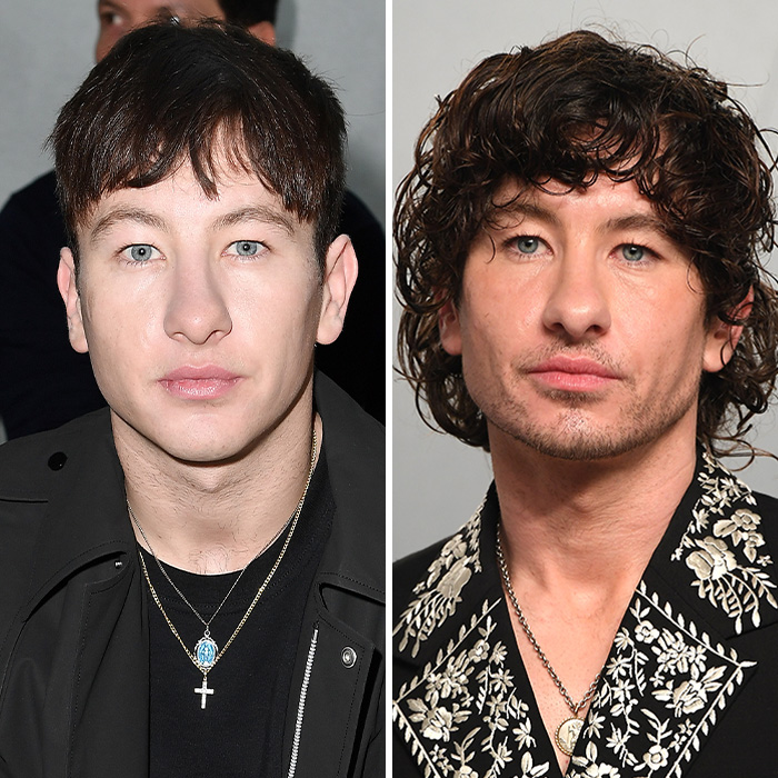 Barry Keoghan Undergoes $6,000 Cosmetic Procedure For Upcoming Role As Backlash Over His Appearance Mounts Barry Keoghan Undergoes $6,000 Cosmetic Procedure For Upcoming Role As Backlash Over His Appearance Mounts