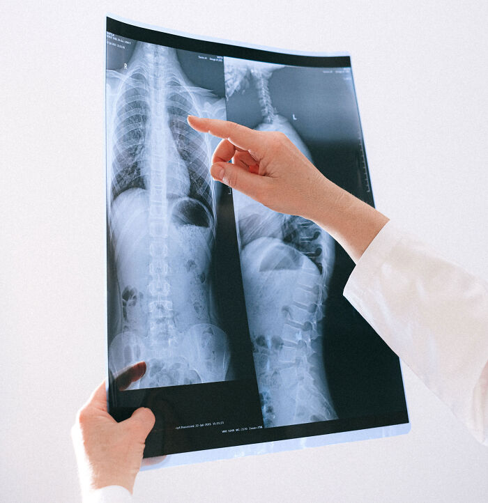 Husband Breaks Silence After Breaking 5 Of Wife’s Ribs By Giving Her A Hug Husband Breaks Silence After Breaking 5 Of Wife’s Ribs By Giving Her A Hug