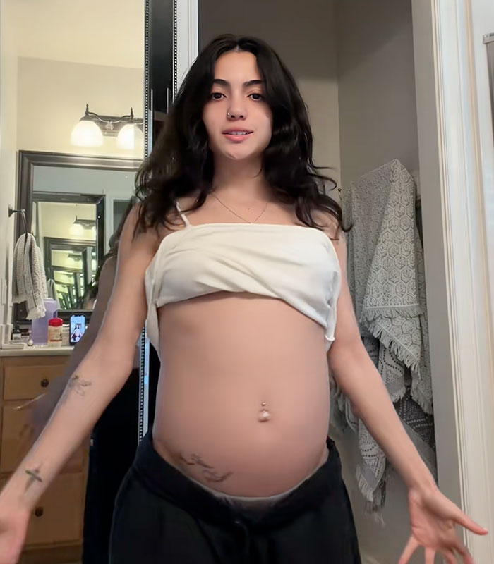 Woman Tried Diet And Exercise For Years To Fix Belly, Shows Off Transformation After Finally Figuring Out The Problem