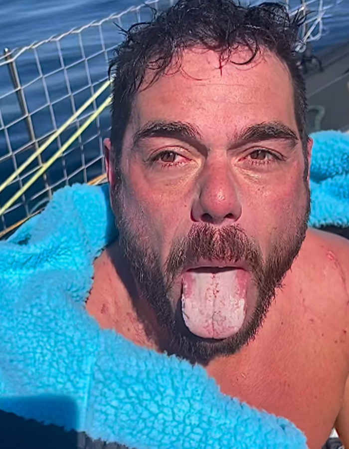 Extreme Swimmer Reveals Horrifying Phenomenon That Happened To His Tongue During Nearly 2,000-Mile Challenge Extreme Swimmer Reveals Horrifying Phenomenon That Happened To His Tongue During Nearly 2,000-Mile Challenge