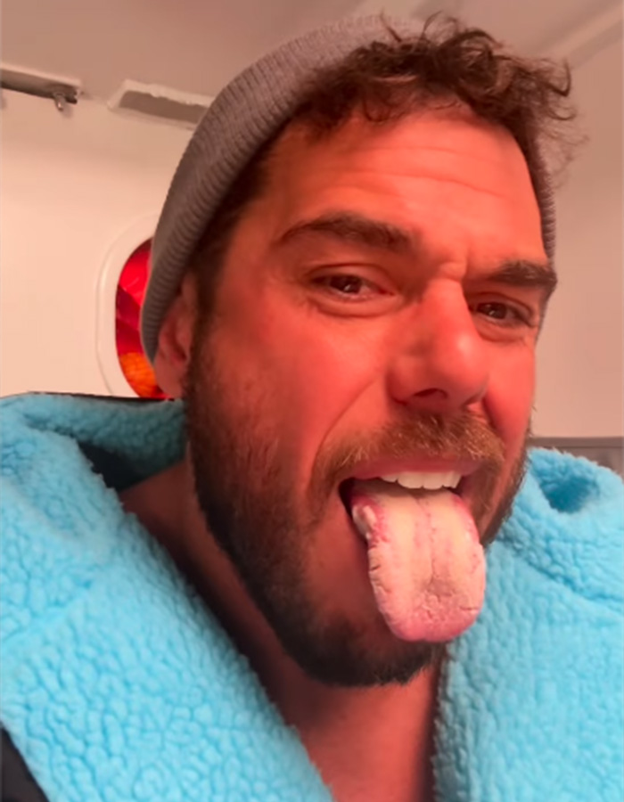Extreme Swimmer Reveals Horrifying Phenomenon That Happened To His Tongue During Nearly 2,000-Mile Challenge Extreme Swimmer Reveals Horrifying Phenomenon That Happened To His Tongue During Nearly 2,000-Mile Challenge