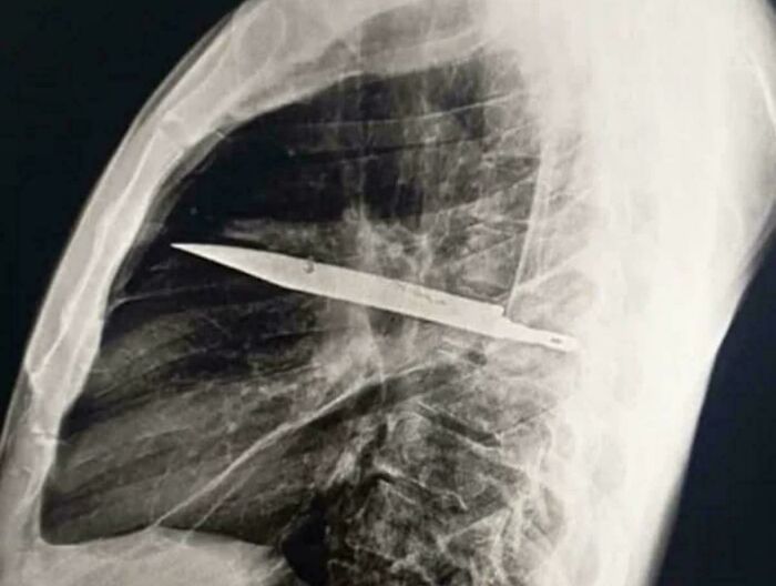 83 Wholesome Photos And Stories That Might Make You Appreciate The Internet Again (New Pics)