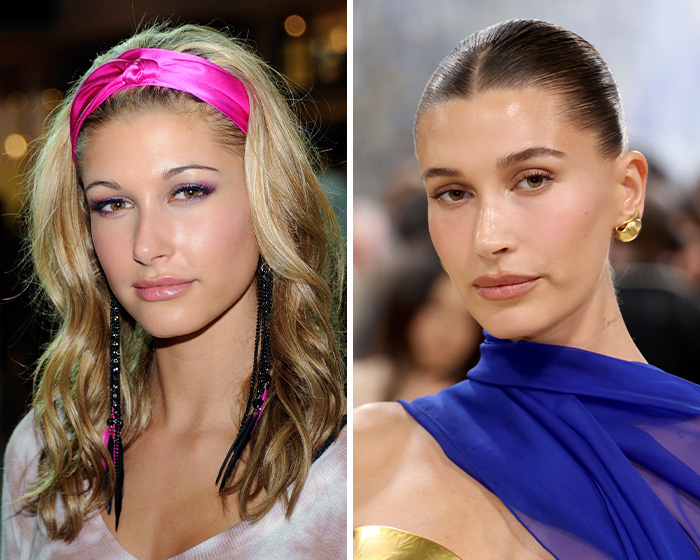 After Jennifer Lawrence’s Viral Plastic Surgery Transformation And Confession, Here Are 8 Other Stars Who Might Have Gotten Blepharoplasty