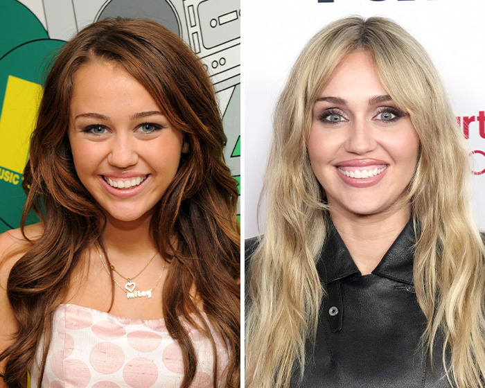 After Jennifer Lawrence’s Viral Plastic Surgery Transformation And Confession, Here Are 8 Other Stars Who Might Have Gotten Blepharoplasty
