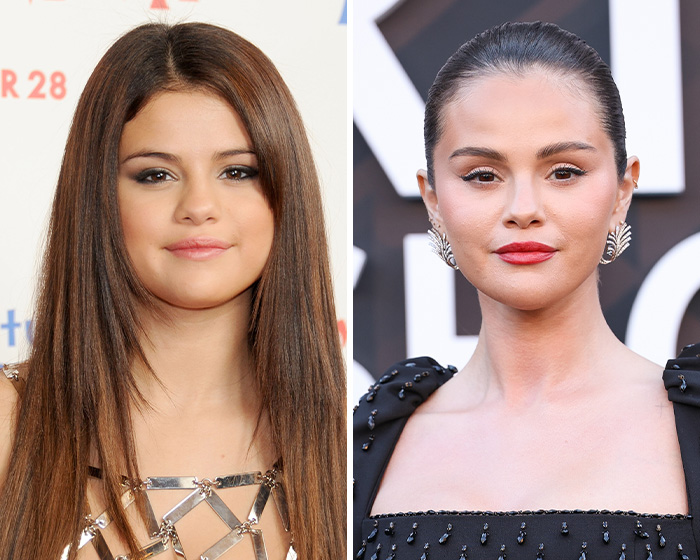 After Jennifer Lawrence’s Viral Plastic Surgery Transformation And Confession, Here Are 8 Other Stars Who Might Have Gotten Blepharoplasty