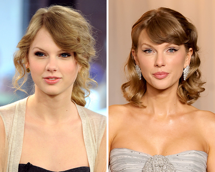 After Jennifer Lawrence’s Viral Plastic Surgery Transformation And Confession, Here Are 8 Other Stars Who Might Have Gotten Blepharoplasty